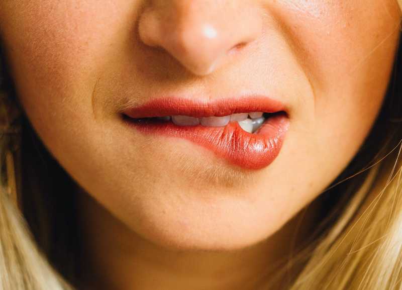 Treating Your Cold Sores With CBD